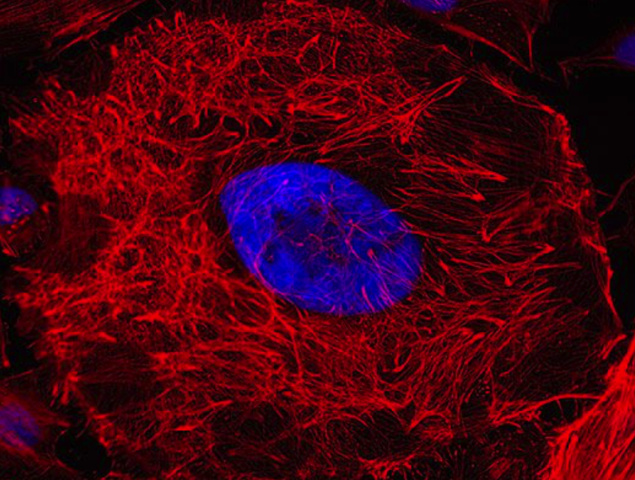 Клетки hela. Hela клетки. Морфология клеток hela. Фибриноген флюоресценция. Fluorescence tomography Light up.